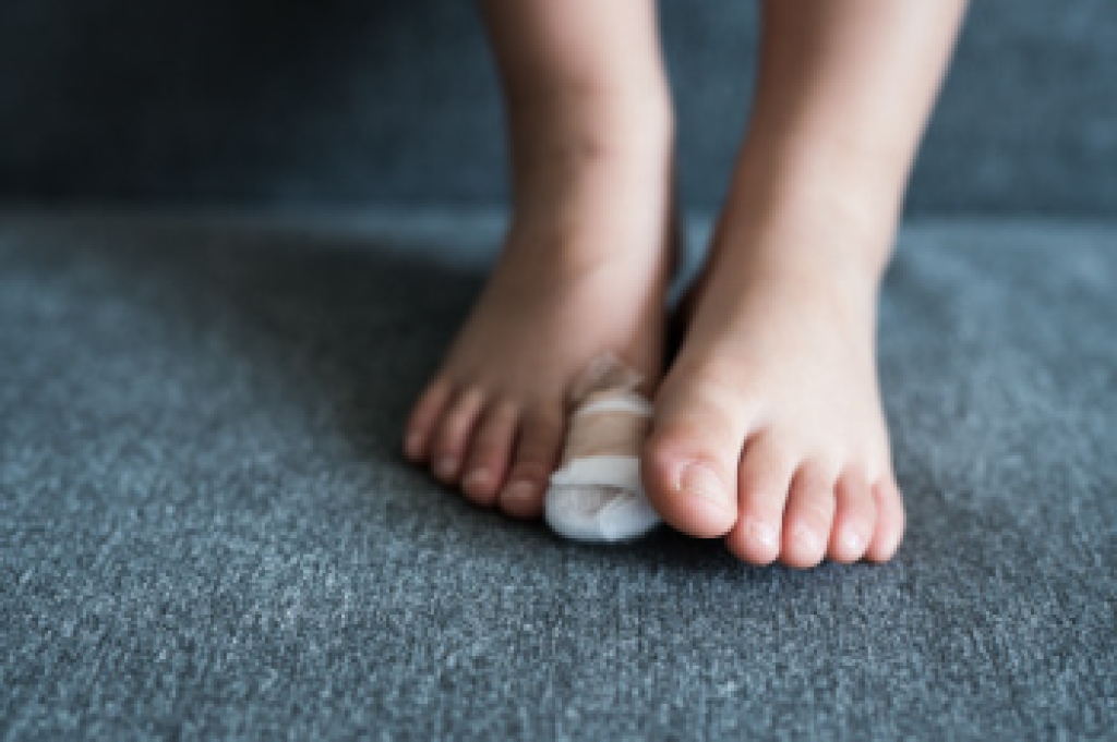 Toe Fractures Explained