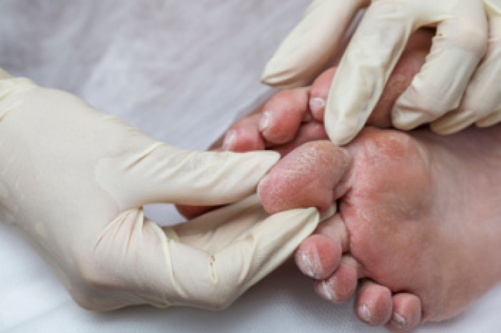 How a Podiatrist Helps With Diabetic Foot Care