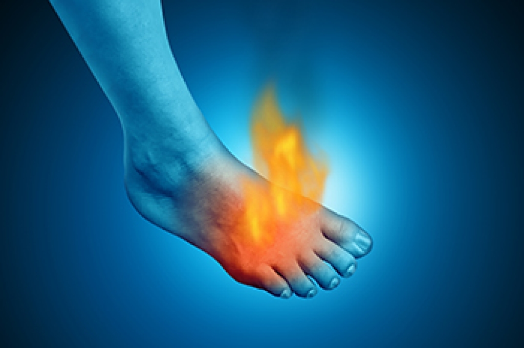 Burning Feet and What the Sensation May Mean